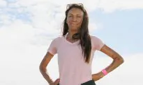 True Love Story of a Former Model Who Suffers Burns on Two-Thirds of Her Body