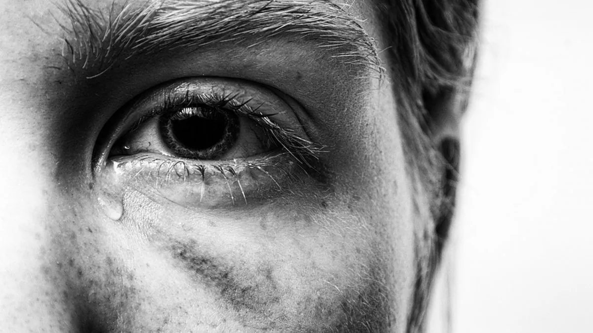 Image of a person with trauma. (Anemone123/Pixabay)