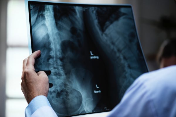 doctor looks at x-ray