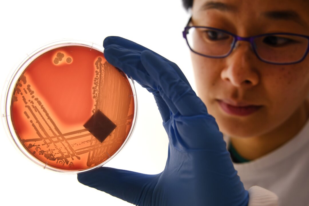 In this file image an agar plate of the superbug Staphylcocus epidermidis is examined in Melbourne on Sept. 4, 2018. (William West/AFP/Getty Images)