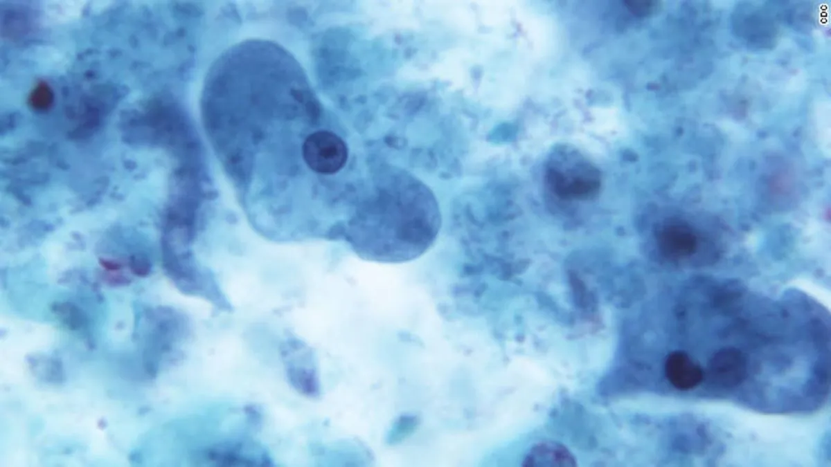 E. coli under a microscope (CDC)