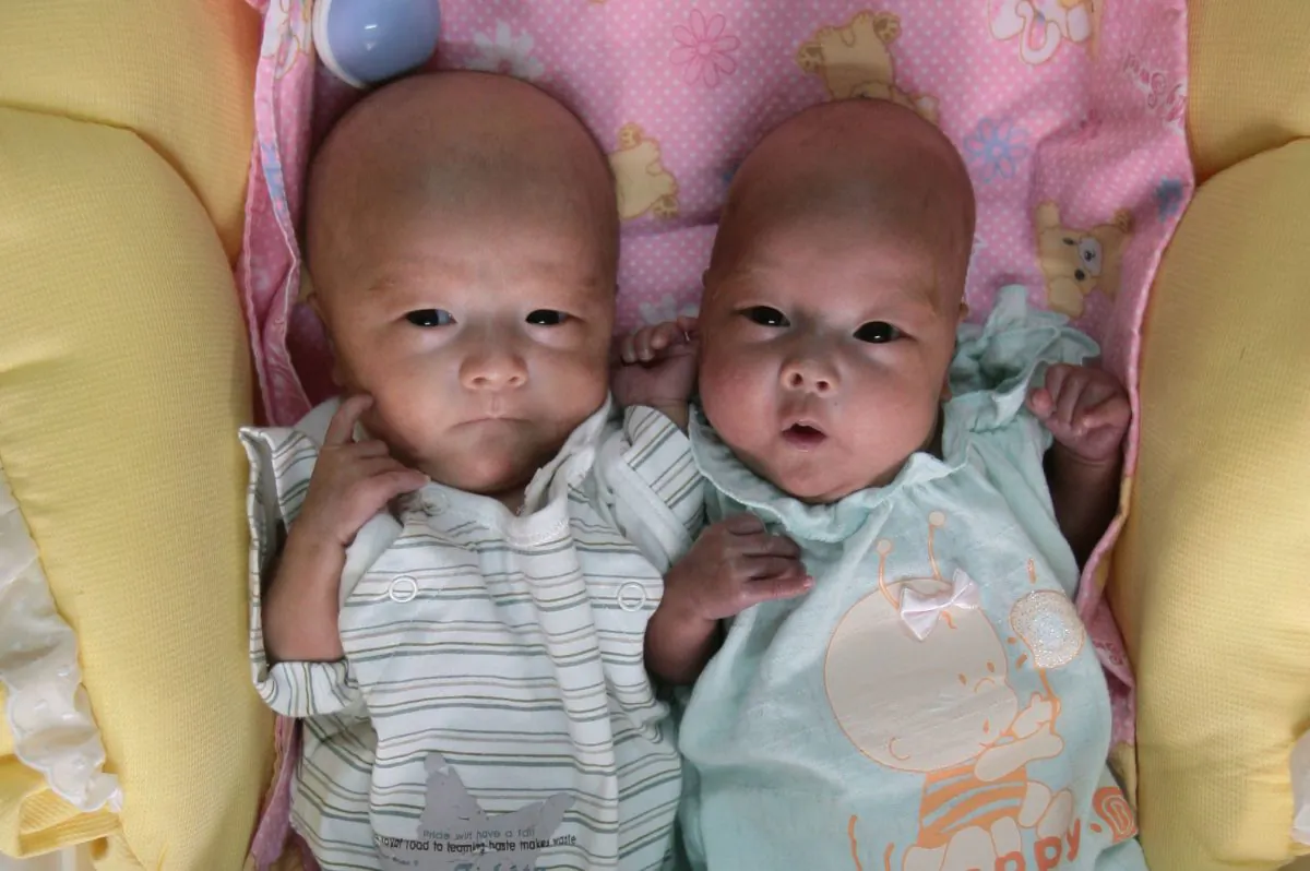 Identical Twin Sisters Spotted ‘fighting In Mothers Womb During Ultrasound Scan 3130