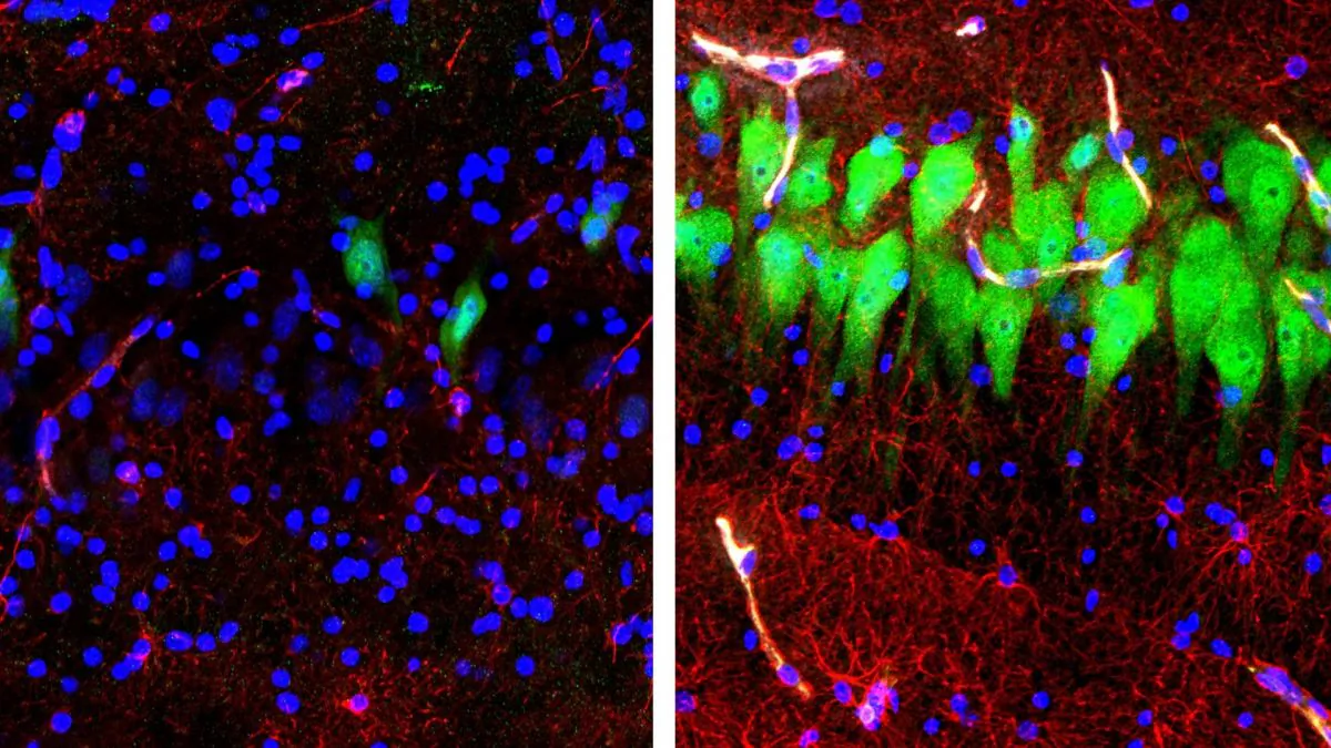 This combination of images provided by the Yale School of Medicine in April 2019 shows stained microscope photos of neurons, green; astrocytes, red, and cell nuclei, blue, from a pig brain left untreated for 10 hours after death, left, and another with a specially designed blood substitute pumped through it. By medical standards “this is not a living brain,” said Nenad Sestan of the Yale School of Medicine, one of the researchers reporting the results on April 17, 2019, in the journal Nature. (Stefano G. Daniele, Zvonimir Vrselja/Sestan Laboratory/Yale School of Medicine)