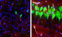 Scientists Restore Some Activity in Brains of Slaughtered Pigs
