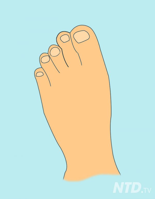 Here Are 13 Types of Toes and the Fascinating Clues They Reveal About ...