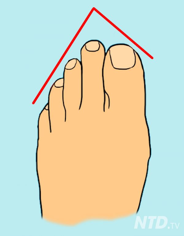 Different Types Of Toe Lengths at Yolanda Borgen blog