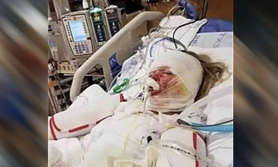 Candle Engulfed a Sofa in Flames and Burned a 6-Year-Old in Neighboring Apartment