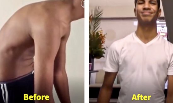 Video: teenager with severe back pain can barely walk, but look at him again after 10-day therapy