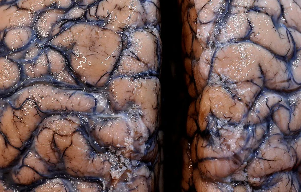 A human brain is seen at the psychiatric hospital in Duffel, Belgium, on July 19, 2017. (Yves Herman/Reuters)