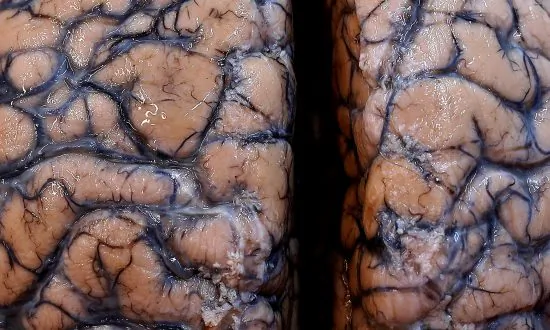Rare Brain-Eating Amoeba Infection Confirmed in a Man in Florida