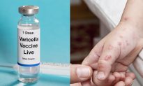 Childhood Shingles Resulting from Chickenpox Vaccination: “Rare” or Predictable?