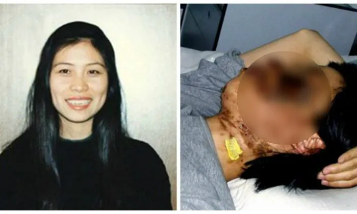 (L) Gao Rongrong before the Falun Dafa persecution campaign was launched. R Gao Rongrong 10 days after her face was shocked repeatedly with electric batons for more than seven hours by guards at the Longshan Forced Labor Camp, simply because she practiced Falun Dafa. (MInghui.org) 