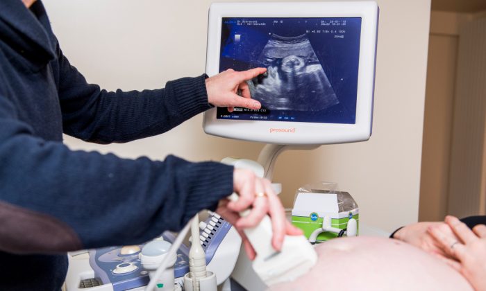 A pregnant woman receiving an ultrasound exam in an illustration photograph. (Jasper Jacobs/AFP/Getty Images)