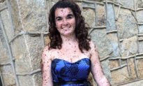 Woman Born With Body Covered in Hundreds of Birthmarks Says She’s ‘Proud to Be Different’