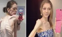 On the Brink of Death, Anorexic Teen Weighed 55lb – but Bodybuilding Saved Her Life