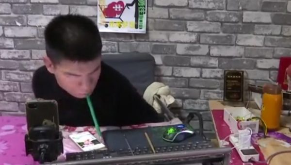 Cerebral palsy origami