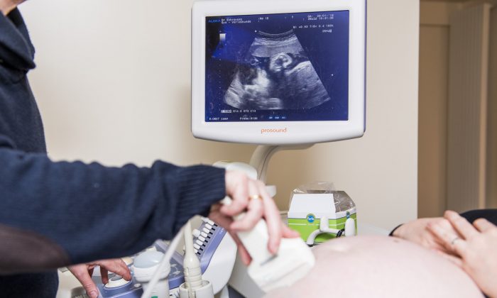 A doctor performs an ultrasound on a pregnant woman during her visit to a gynecologist in a file photo. (Jennifer Jacobs/AFP/Getty Images)