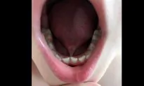Boy Believed to Be Nonverbal Can Speak After Dentist Finds He’s ‘Tongue-Tied’