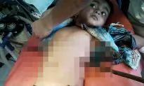 3-Year-Old Miraculously Survives After Falling on Iron Rod That Skewered His Chest