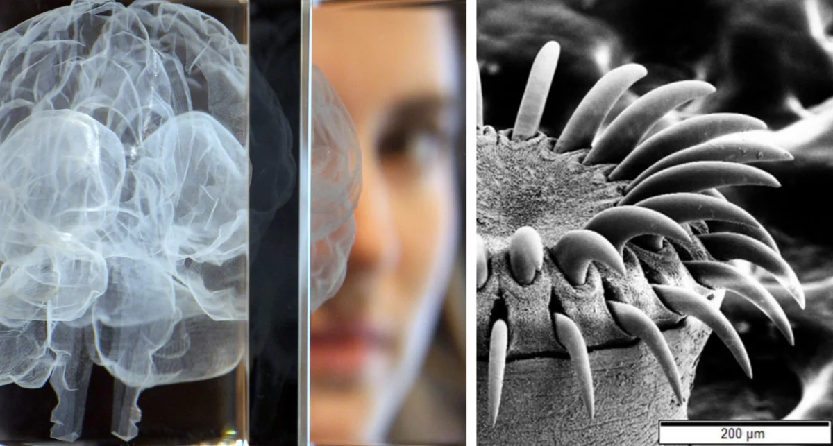 R: A woman poses behind an artwork in the shape of a brain on March 27, 2012 in London, England. (Dan Kitwood/Getty Images) L: An electron microscope image of a tapeworm's head. ("Tapeworm SEM" by Mogana Das Murtey and Patchamuthu Ramasamy (CC BY-SA 3.0 ept.ms/2Bw5evC)