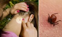 Want to Avoid Tick Bites This Summer? Here Are 5 Cheapest Tips You Should Know