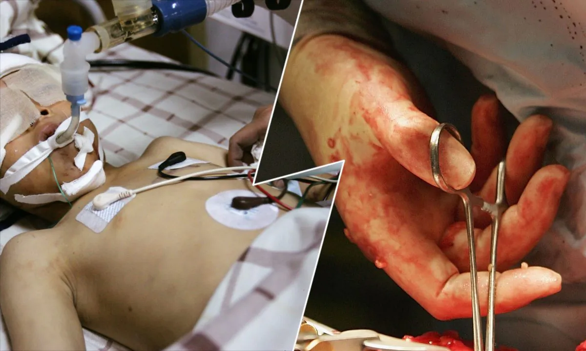 (L) A hospitalized Chinese boy. (China Photos/Getty Images) -- (R) Kidney transplant operation. (Christopher Furlong/Getty Images)