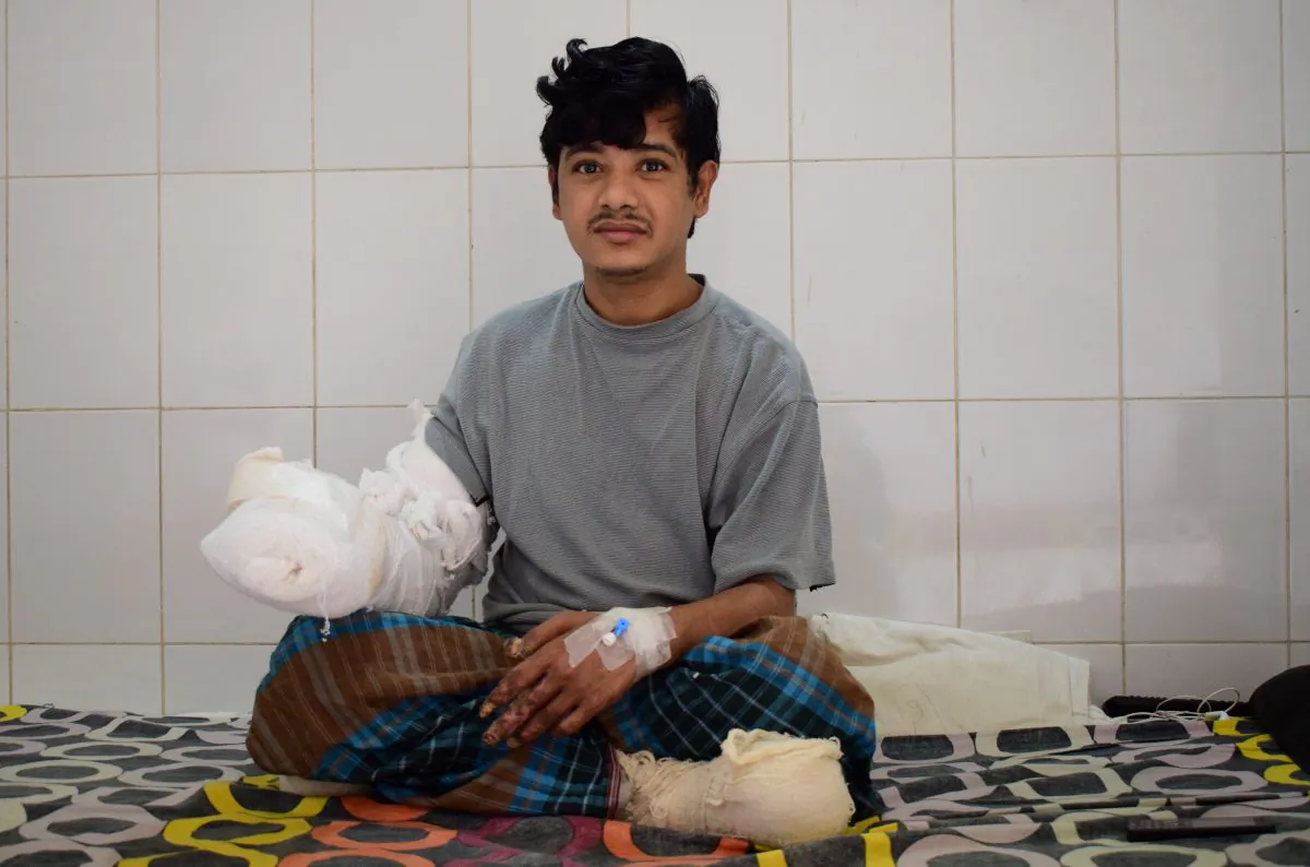 Bangladeshi man Abul Bajandar, widely known as "Tree Man" in Dhaka Medical College Hospital in Dhaka on Jan. 4, 2017. (Sam Jahan/AFP/Getty Images)
