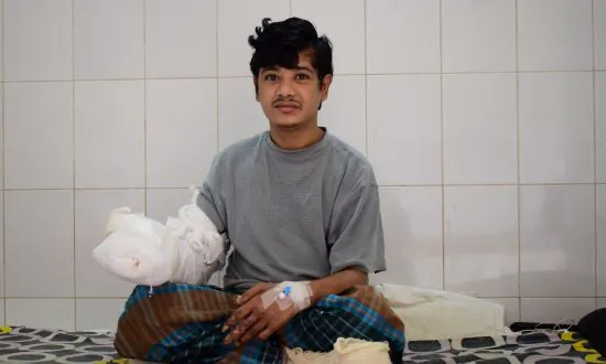 ‘Tree Man’ Asks Surgeons to Amputate His Hands Due to Pain of Bark-Like Growths