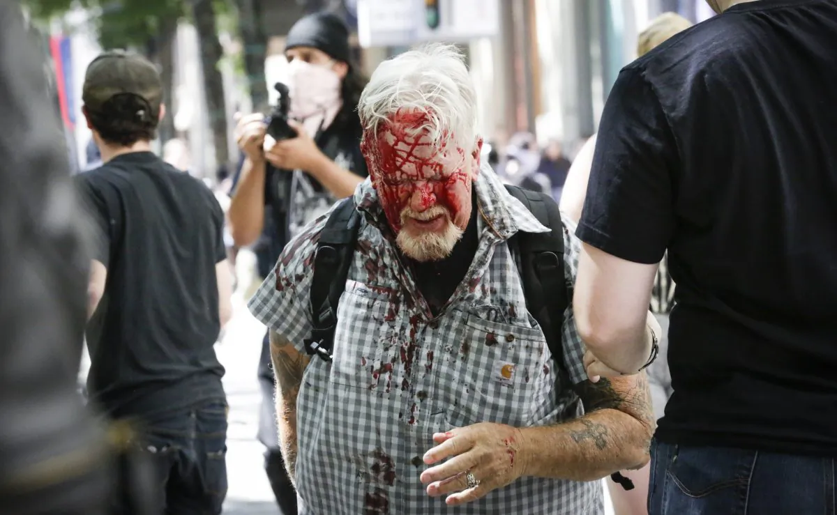 An unidentified protester injured by Antifa extremists at Pioneer Courthouse Square on June 29, 2019. (Moriah Ratner/Getty Images)