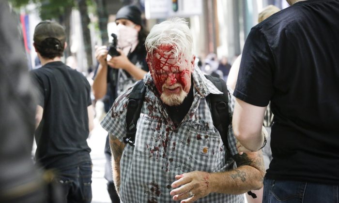 An unidentified protester injured by Antifa extremists at Pioneer Courthouse Square on June 29, 2019. (Moriah Ratner/Getty Images)