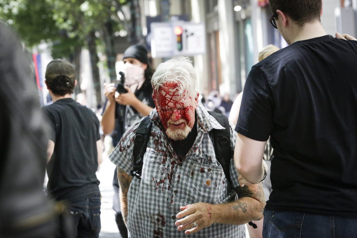 a man covered with his face in blood walks in portland