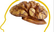 Why Walnut Resembles the Brain It Nourishes