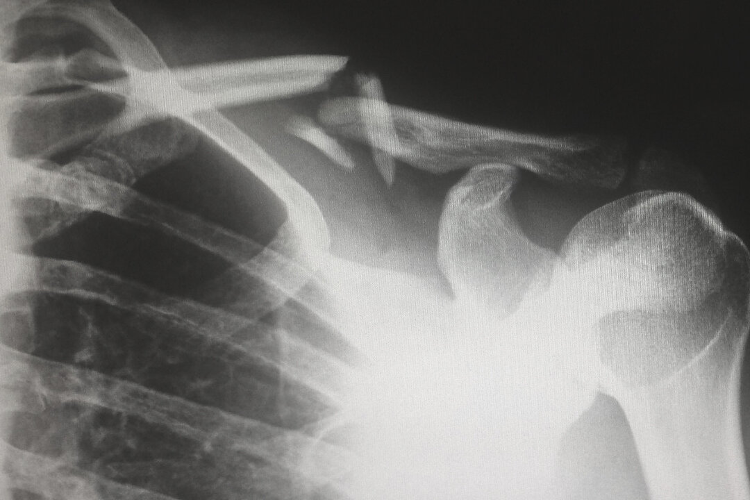 An image showing a scan of part of a skeleton. (Harlie Raethel/Unsplash)