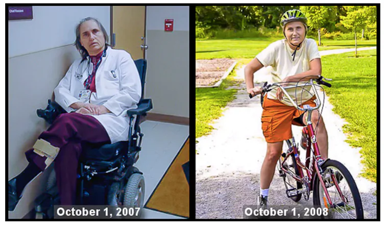 Terry Wahls before and after she changed her diet.
(Courtesy of Terry Wahls)