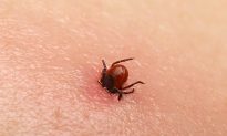 Tick Bites Leave Girl Unable to Move as Doctors Diagnose Rare ‘Tick Paralysis’