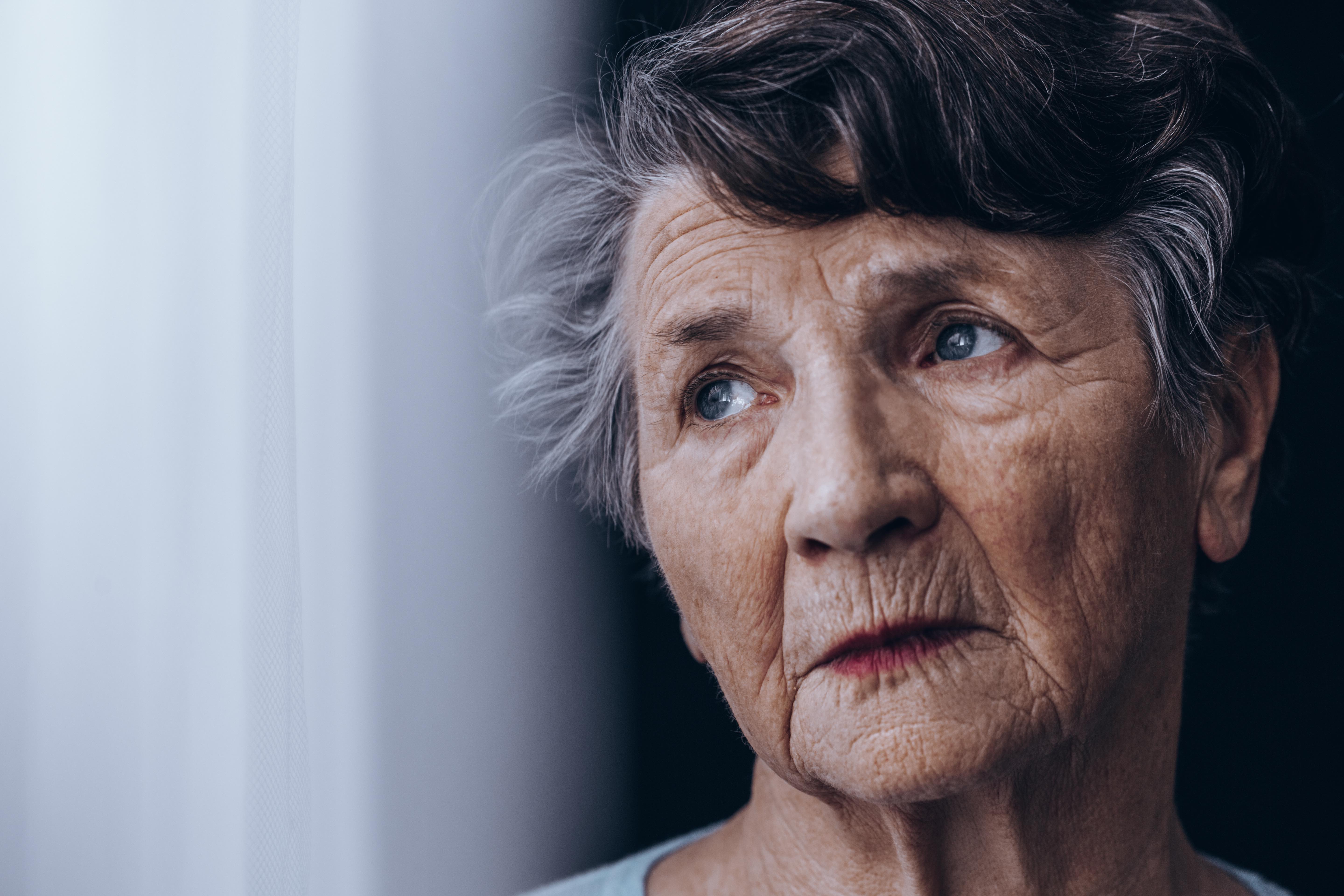 Слабоумие картинки. Деменция Альцгеймера. Красивая пожилая женщина. Старческое лицо. Люди с Альцгеймером.