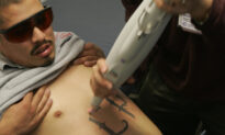 Tattoo Removal Can Give Inmates a New Lease on Life