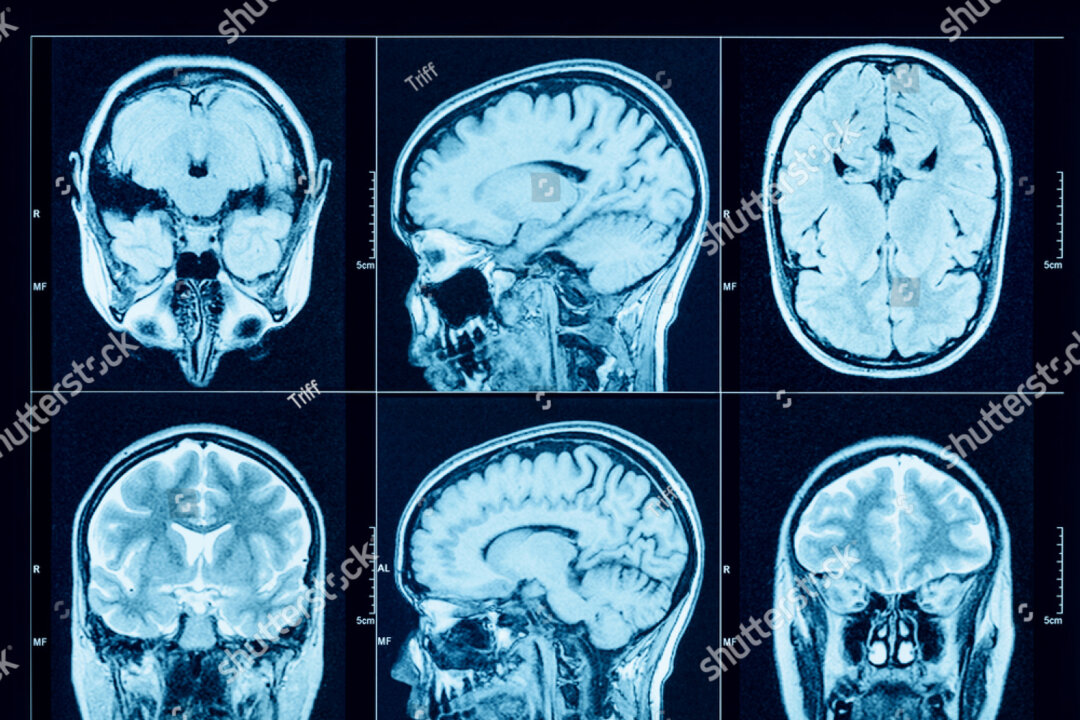 (Triff/Shutterstock)