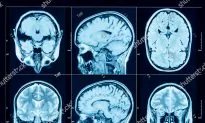 No Trace of Physical Harm Found in Havana Syndrome Patients: Report
