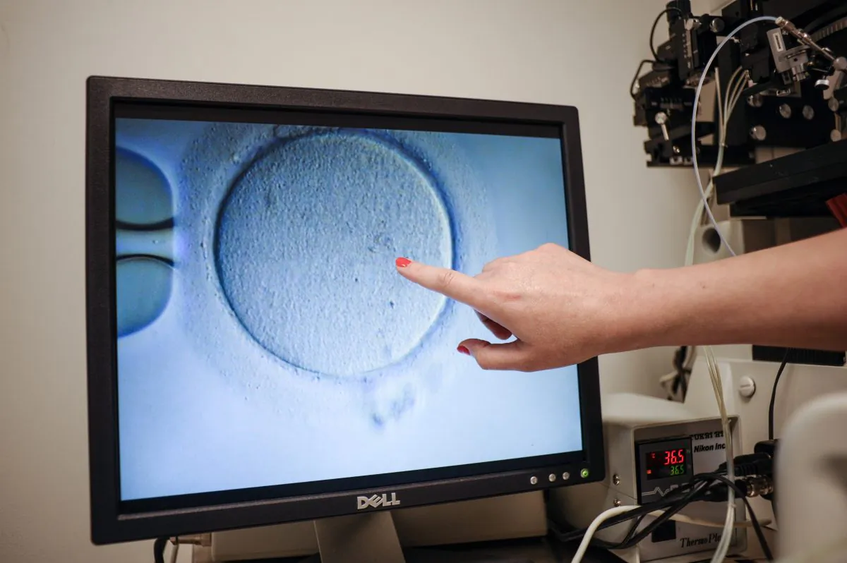 An embryologist shows an Ovocyte after it was inseminated in Virginia, on June 12, 2019. (Ivan CouronneI/AFP/Getty Images)