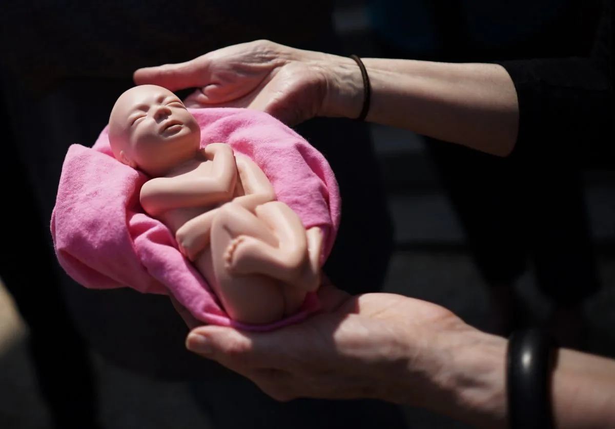An pro-life activist holds a model of an unborn baby in a file photo. (Mandel Ngan/AFP/Getty Images)