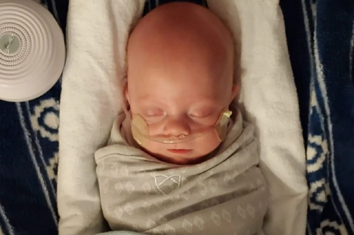 Finn James was born at 1 pound, 2 ounces. (Fighting Finn/GoFundMe)