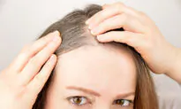 Dealing With Anxiety, Infertility, Hair Loss, Fatigue, And Stubborn Weight? You May Be Iodine Deficient!