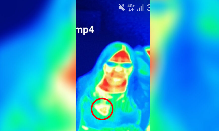 A smartphone photo of a thermal image showing Bal Gill's hot spots;  the yellow hotspot in the image is the breast cancer. (Courtesy of Camera Obscura and World of Illusions)
