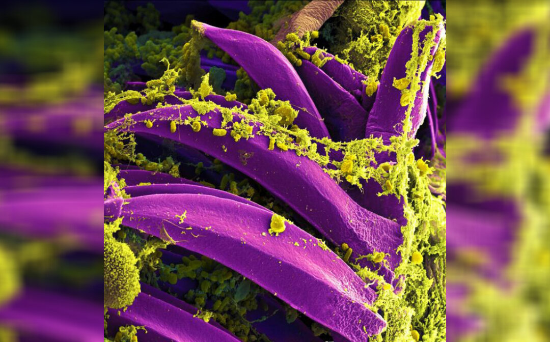 New Mexico Man Diagnosed With Plague in State’s First Case This Year, Say Officials