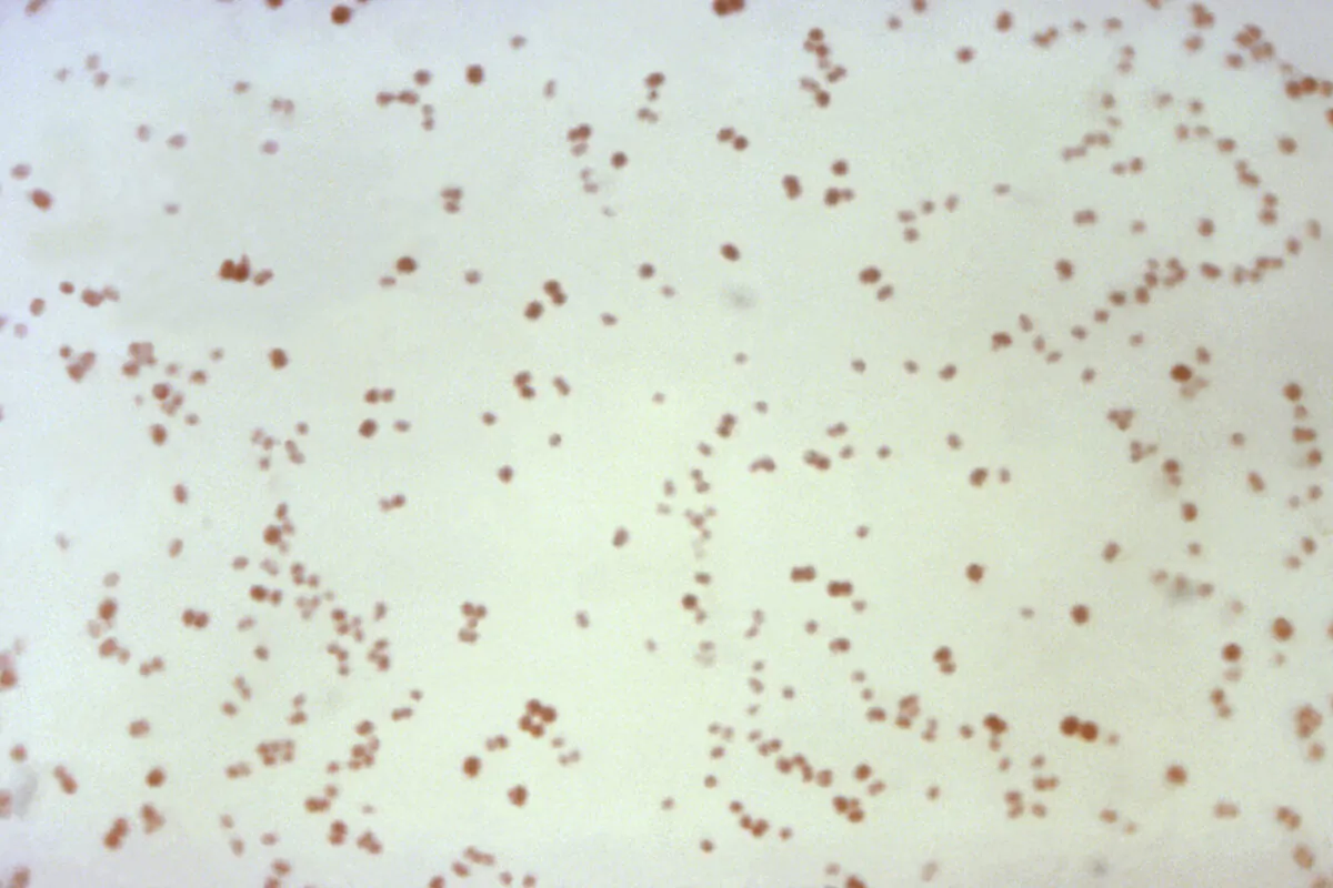 This 1971 microscope image made available by the Centers for Disease Control and Prevention shows Gram-negative, diplococcal, Neisseria gonorrhoeae bacteria, which had been sampled from a culture. (CDC via AP)