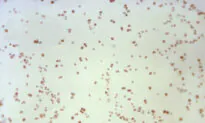 Infections From Antibiotic Resistant ‘Superbugs’ on the Rise, New CDC Report Says