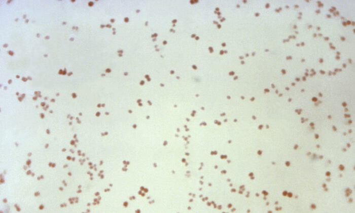 This 1971 microscope image made available by the Centers for Disease Control and Prevention shows Gram-negative, diplococcal, Neisseria gonorrhoeae bacteria, which had been sampled from a culture. (CDC via AP)
