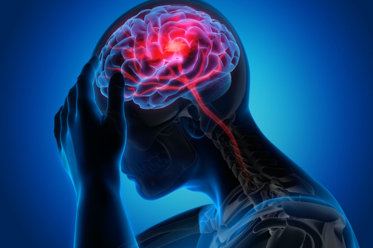 For some, too much medication might make migraine worse.(By peterschreiber.media/Shutterstock)