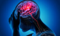 Warning Signs of Stroke Could Appear as Early as 1 Month Prior